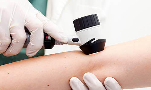 Dermatology