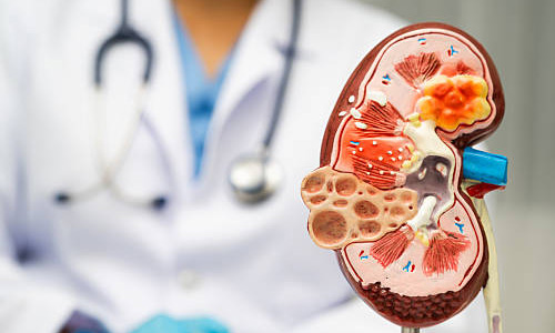 Nephrology