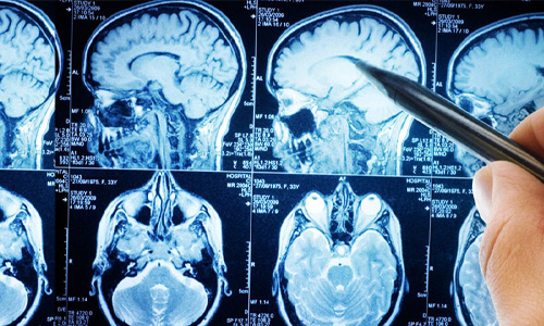 Neurology