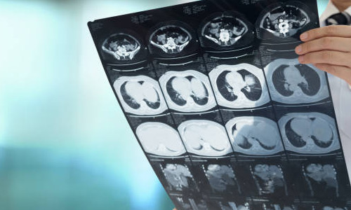 Radiology